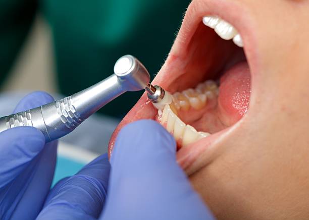 Best Tooth Extraction  in Shullsburg, WI